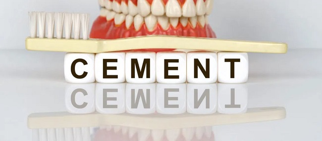 سمان دندانپزشکی چیست؟