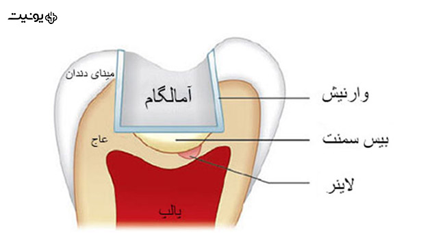 بیس و لاینر چیست؟