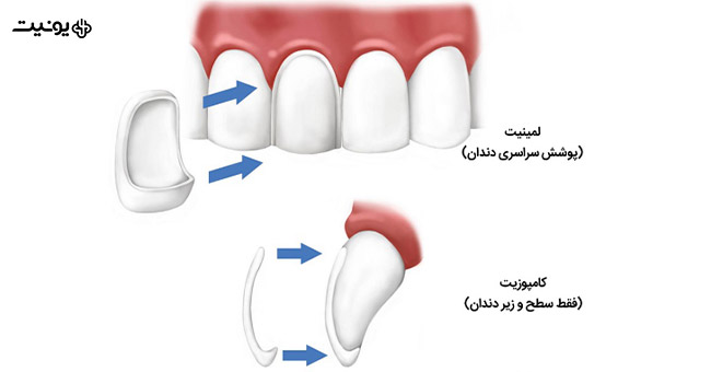 تفاوت لمینیت و کامپوزیت