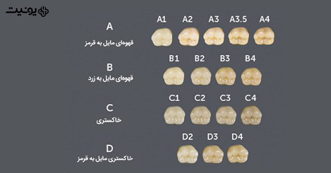 رنگ کامپوزیت دندان