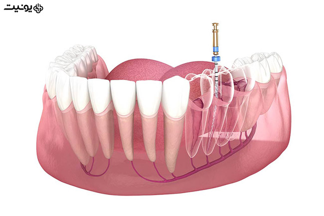 کوربیلداپ دندانپزشکی