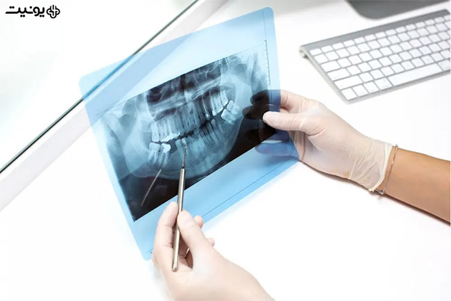 تجهیزات لازم در مطب دندانپزشکی