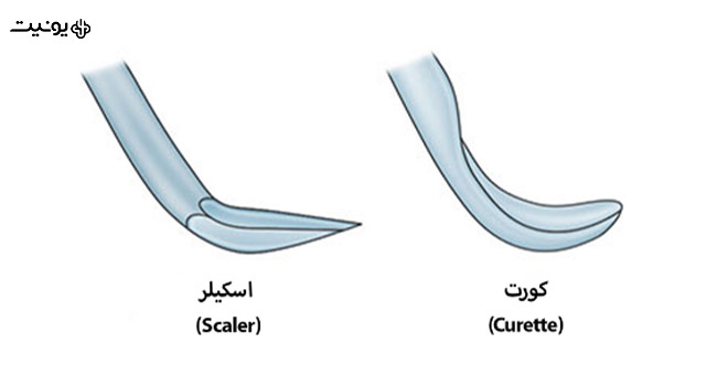 تفاوت بین اسکیلر و کورت دندانپزشکی