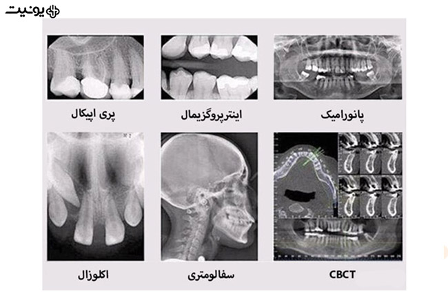 انواع مختلف رادیوگرافی دندانی
