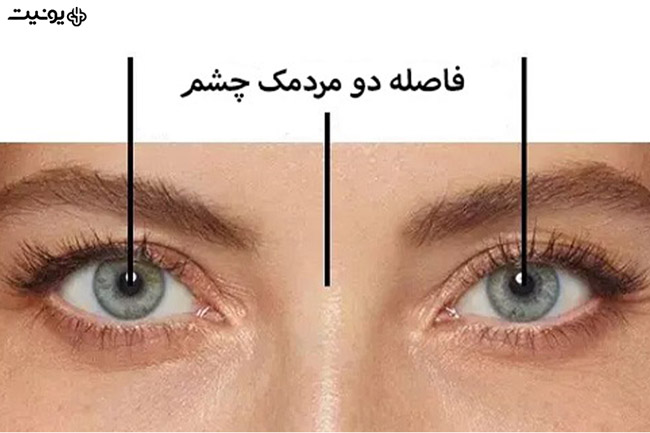 چگونه فاصله بین دو مردمک را اندازه گیری کنیم؟