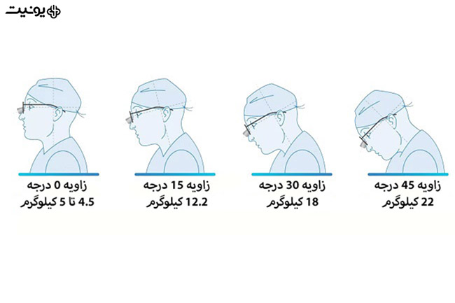 چرا باید از لوپ چشمی استفاده کنم؟