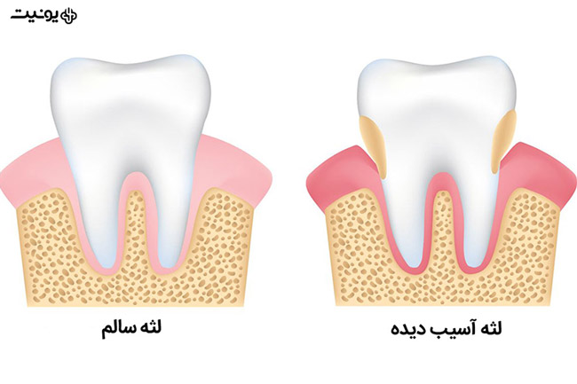 آشنایی با مشکلات رایج دندان