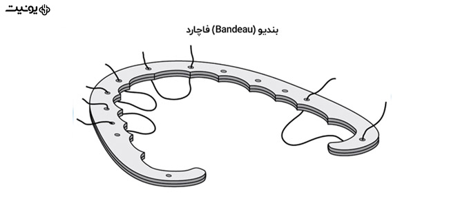 تاریخچه ارتودنسی