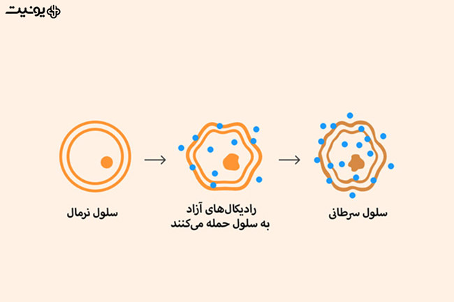 عملکرد دستگاه لایت کیور دندانپزشکی