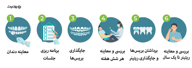 مراحل ارتودنسی دندان