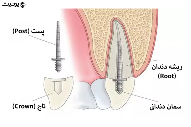 کوربیلداپ دندانپزشکی