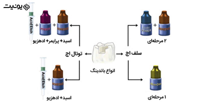 نسل های مختلف باندینگ 