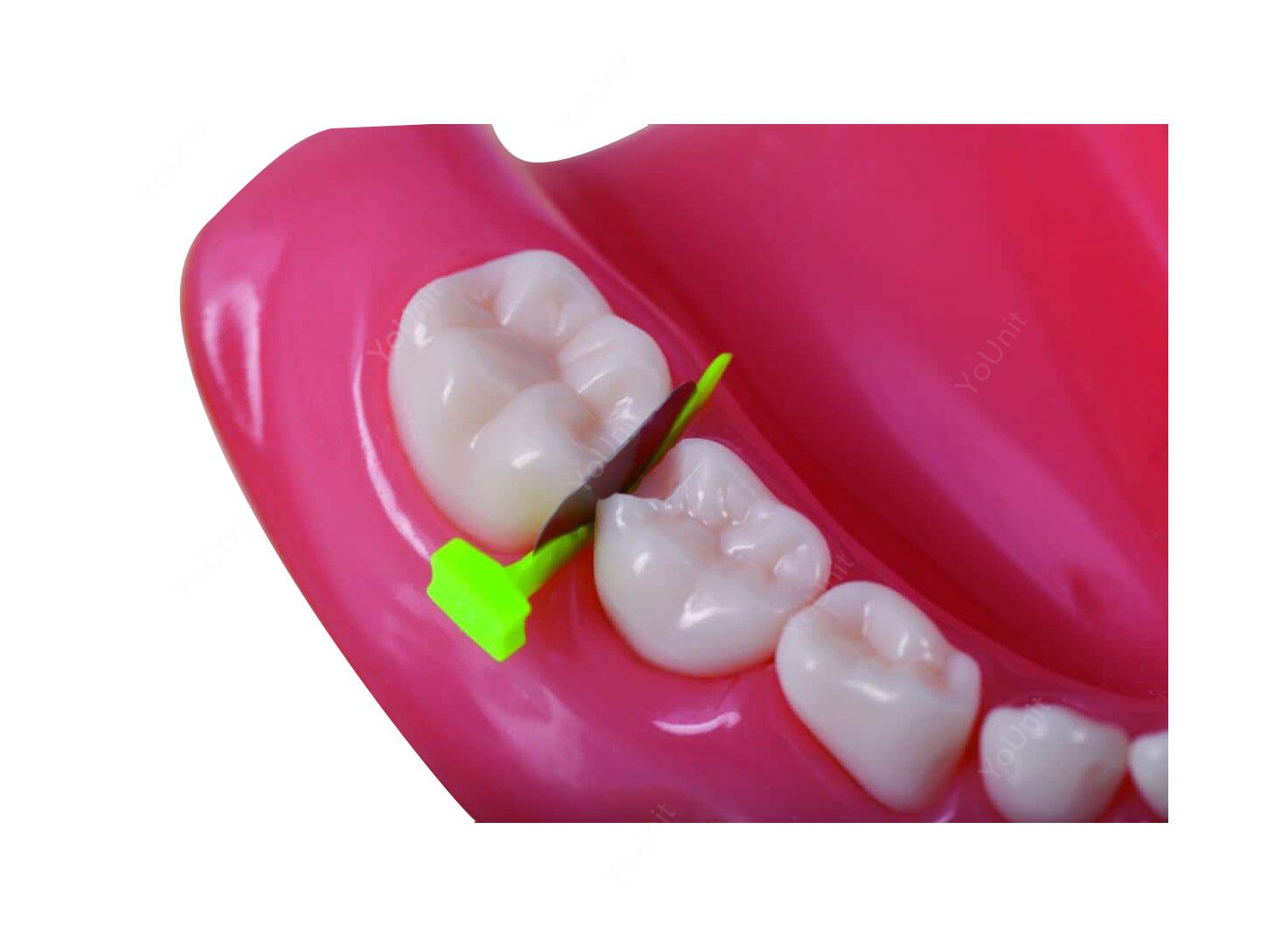 فندرمیت اطفال دندانپزشکی Prime برند Directa
