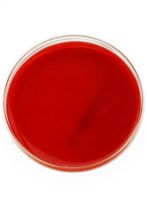 محیط کشت بلاد آگار گوسفندی برند مرک بسته 500 گرمی