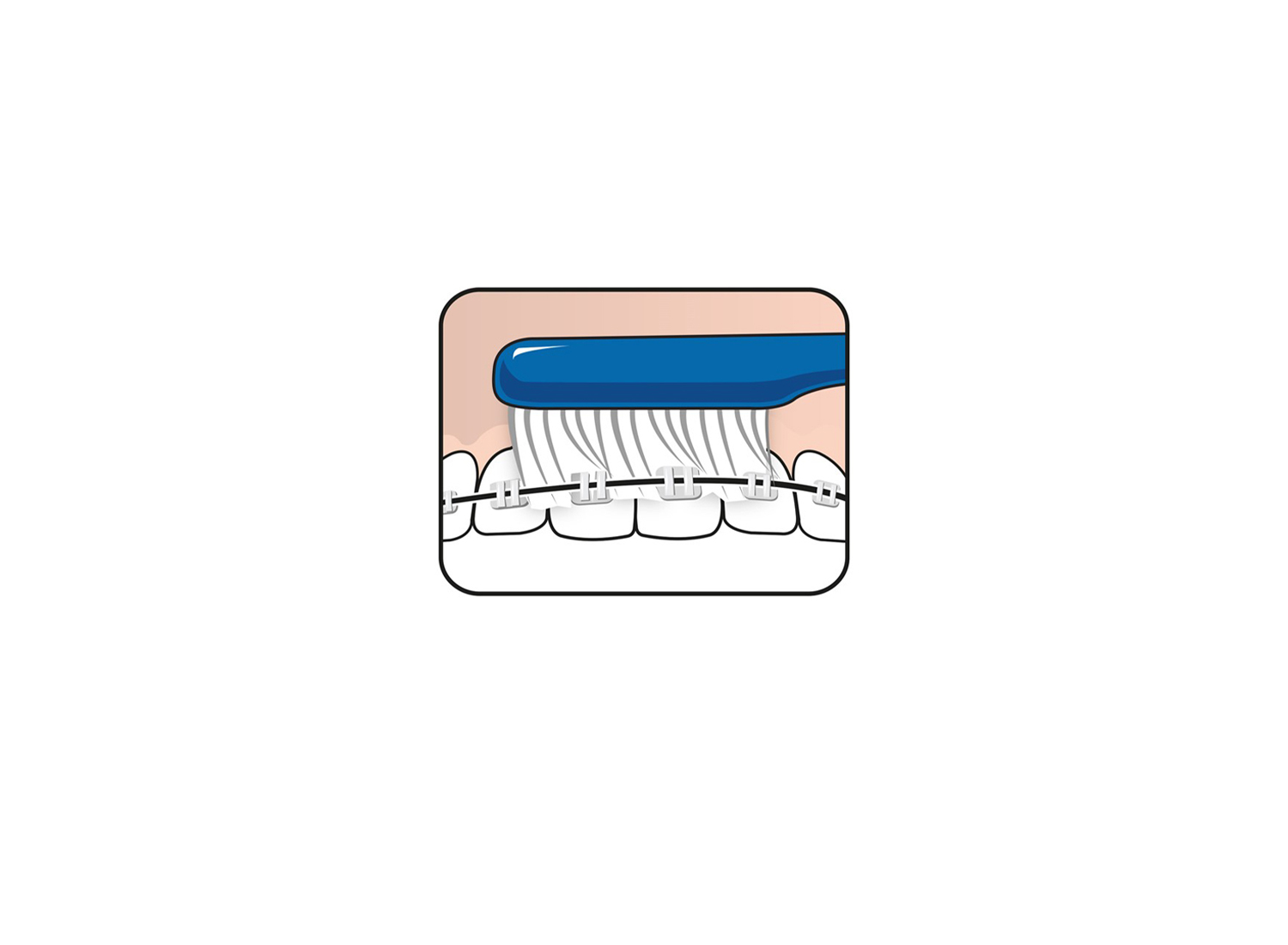 مسواک Implant-Orthodontic برند TePe