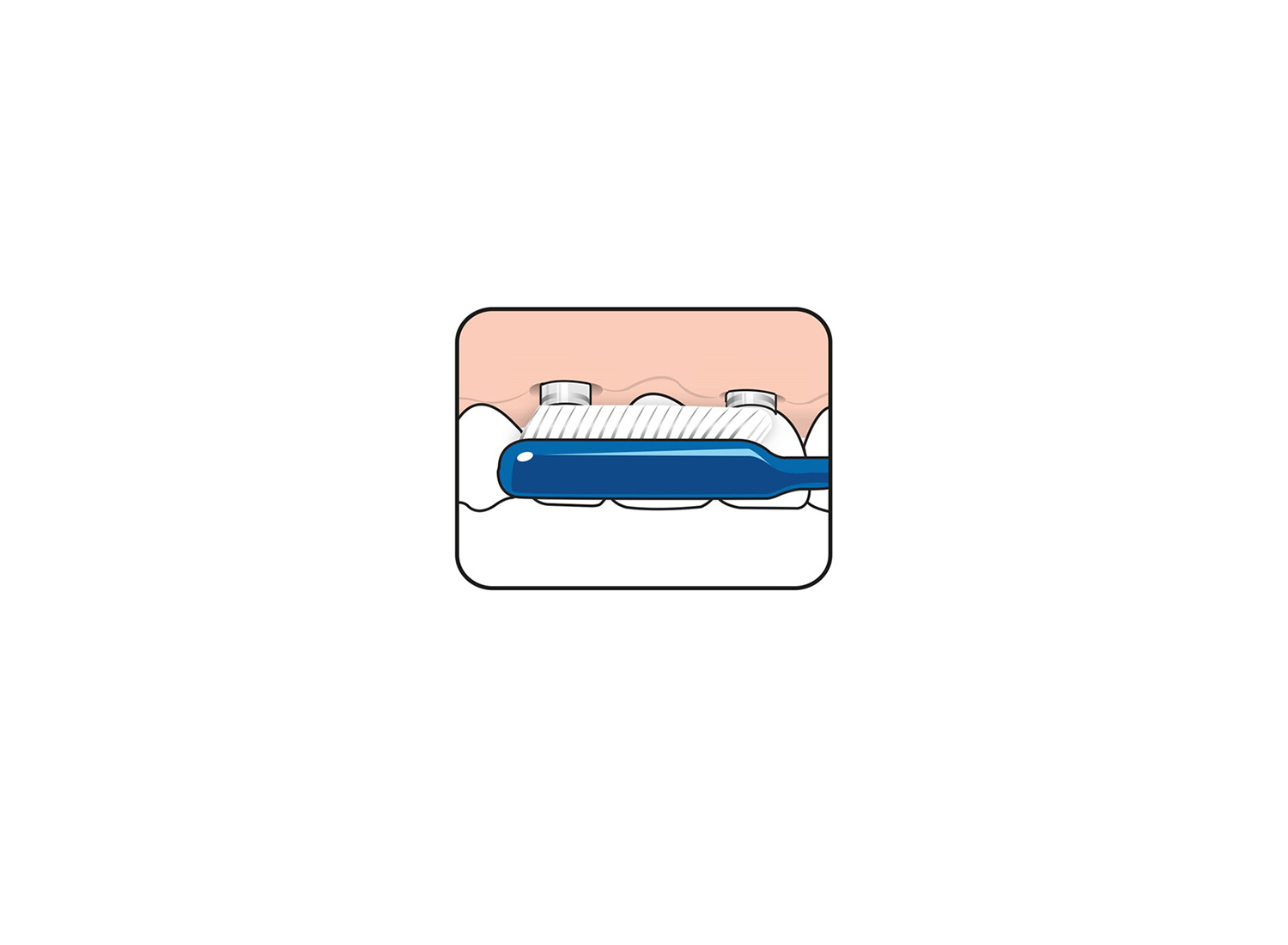 مسواک Implant-Orthodontic برند TePe