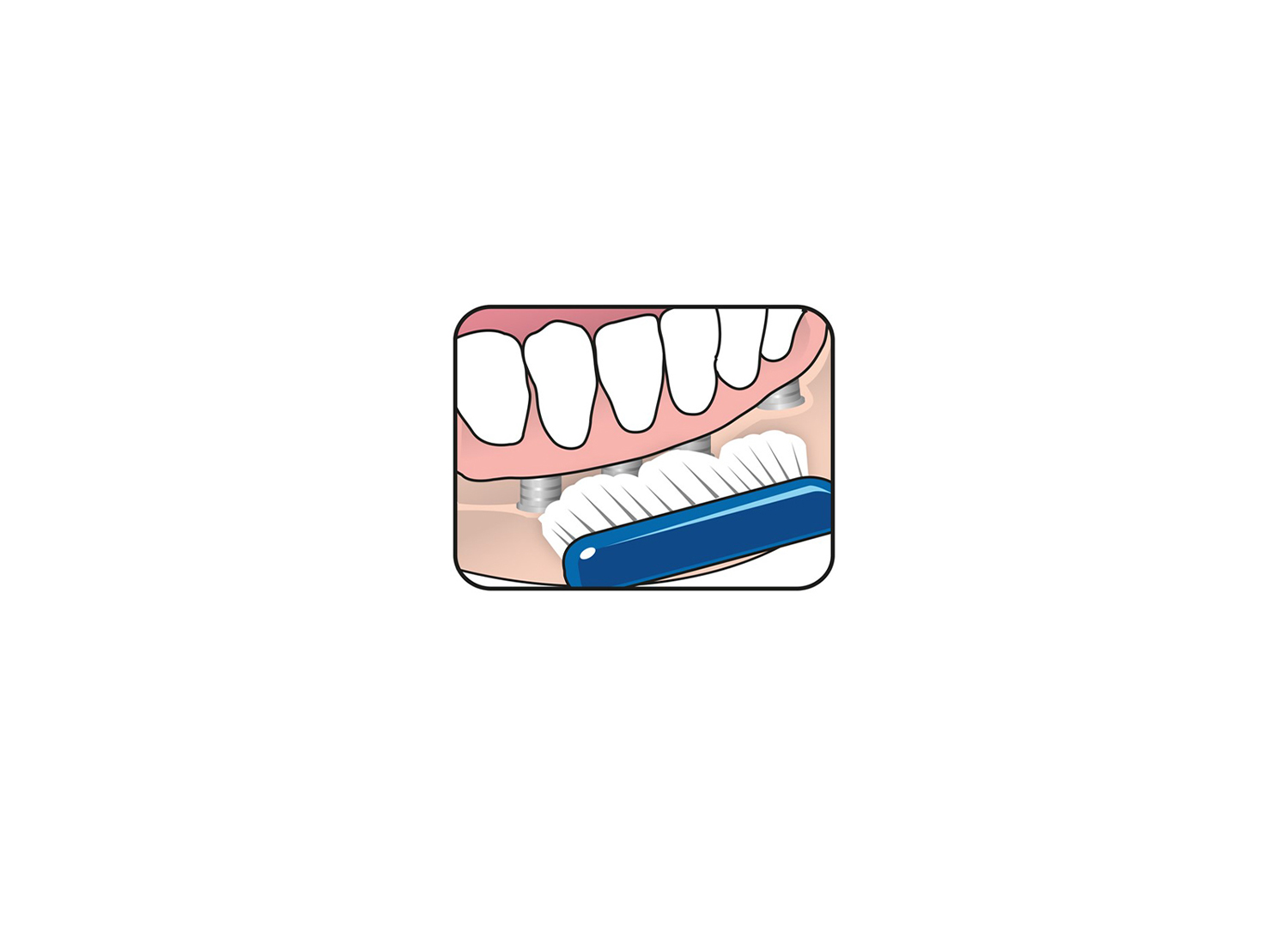 مسواک Implant-Orthodontic برند TePe