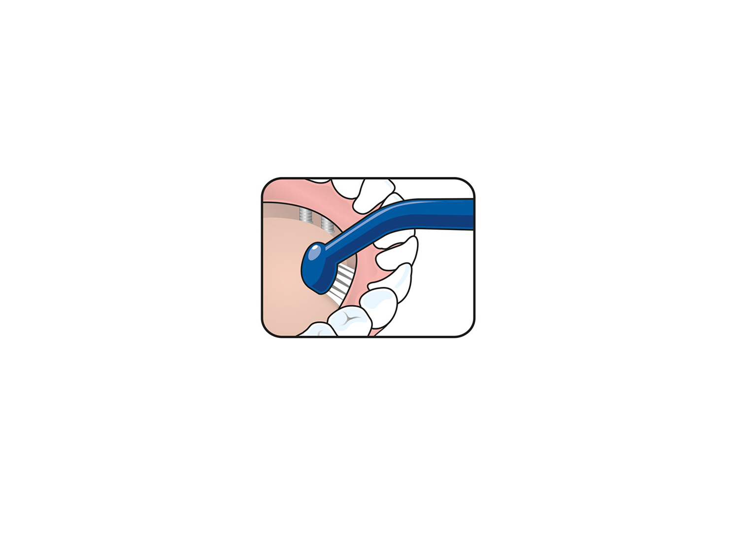 مسواک universal Care برند TePe