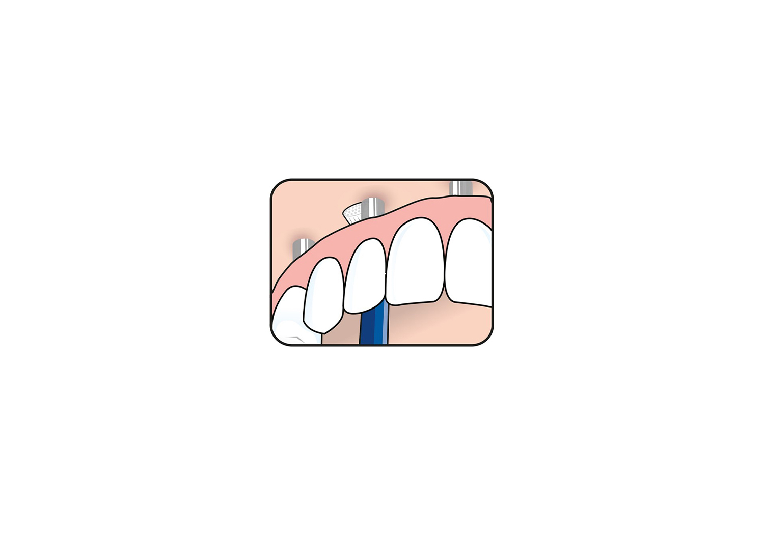 مسواک universal Care برند TePe