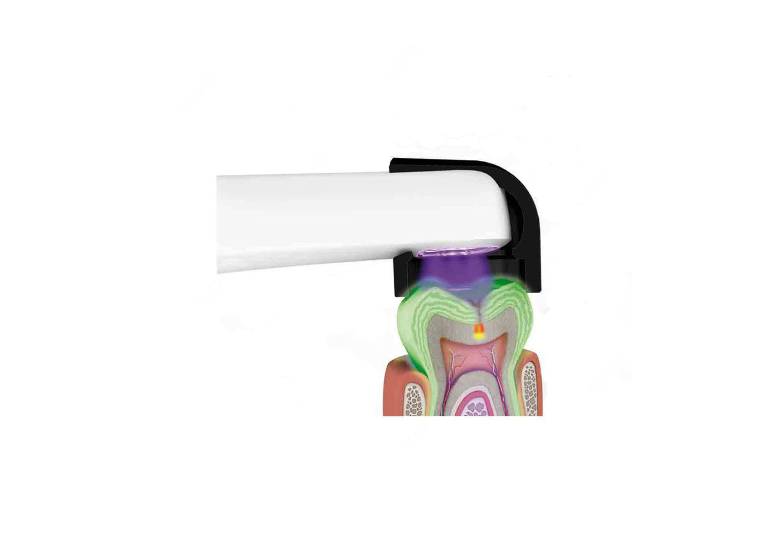 دوربین داخل دهانی مولتی فانکشنال مدل VistaCam iX برند Durr Dental