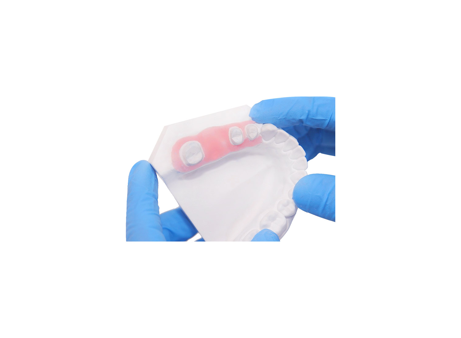 جینجیوال ماسک Gingiva Mask برند VINCISMILE