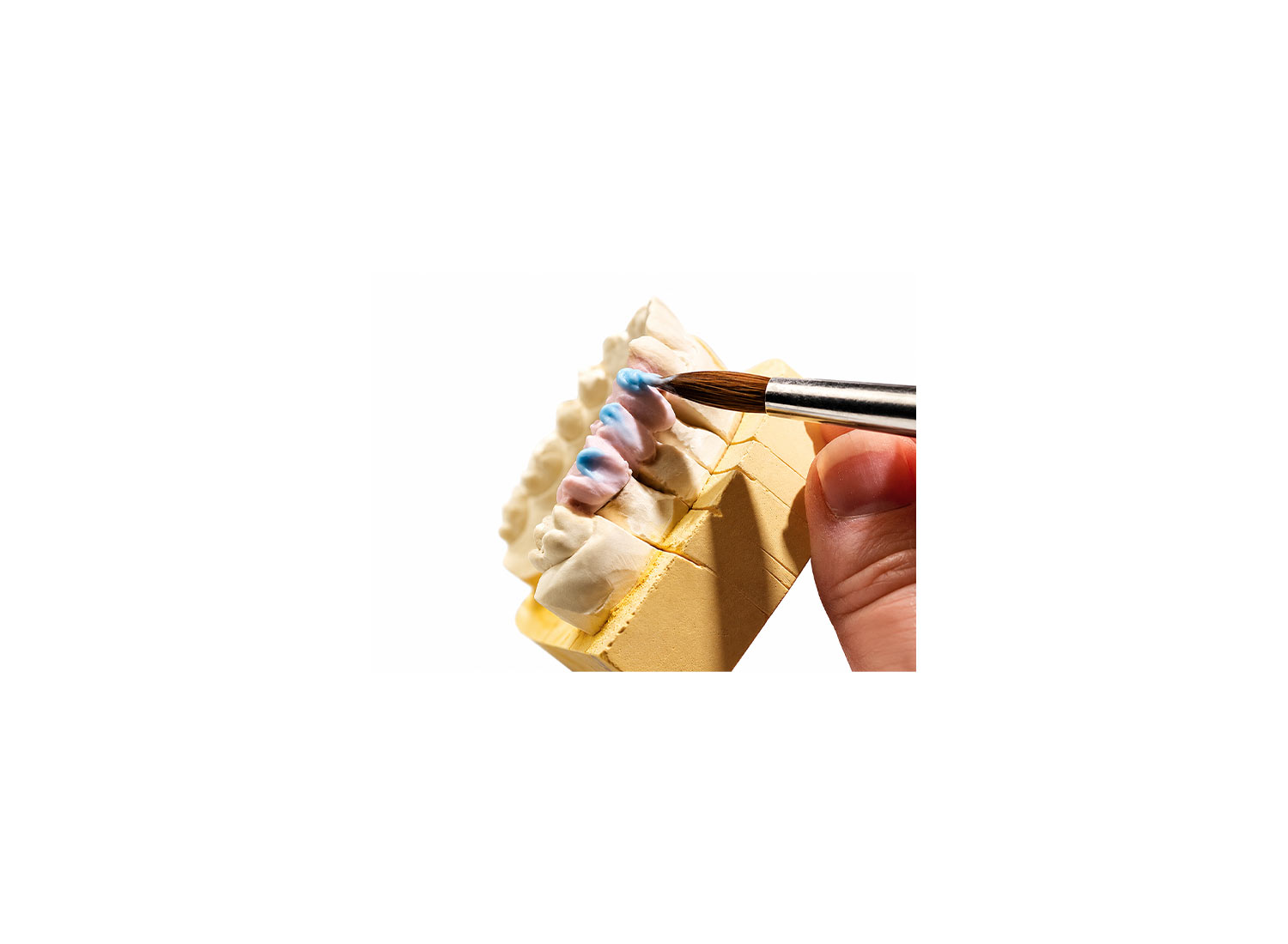 پودر Add-On پرسلن متال سرامیک PFM برند Dentsply Sirona