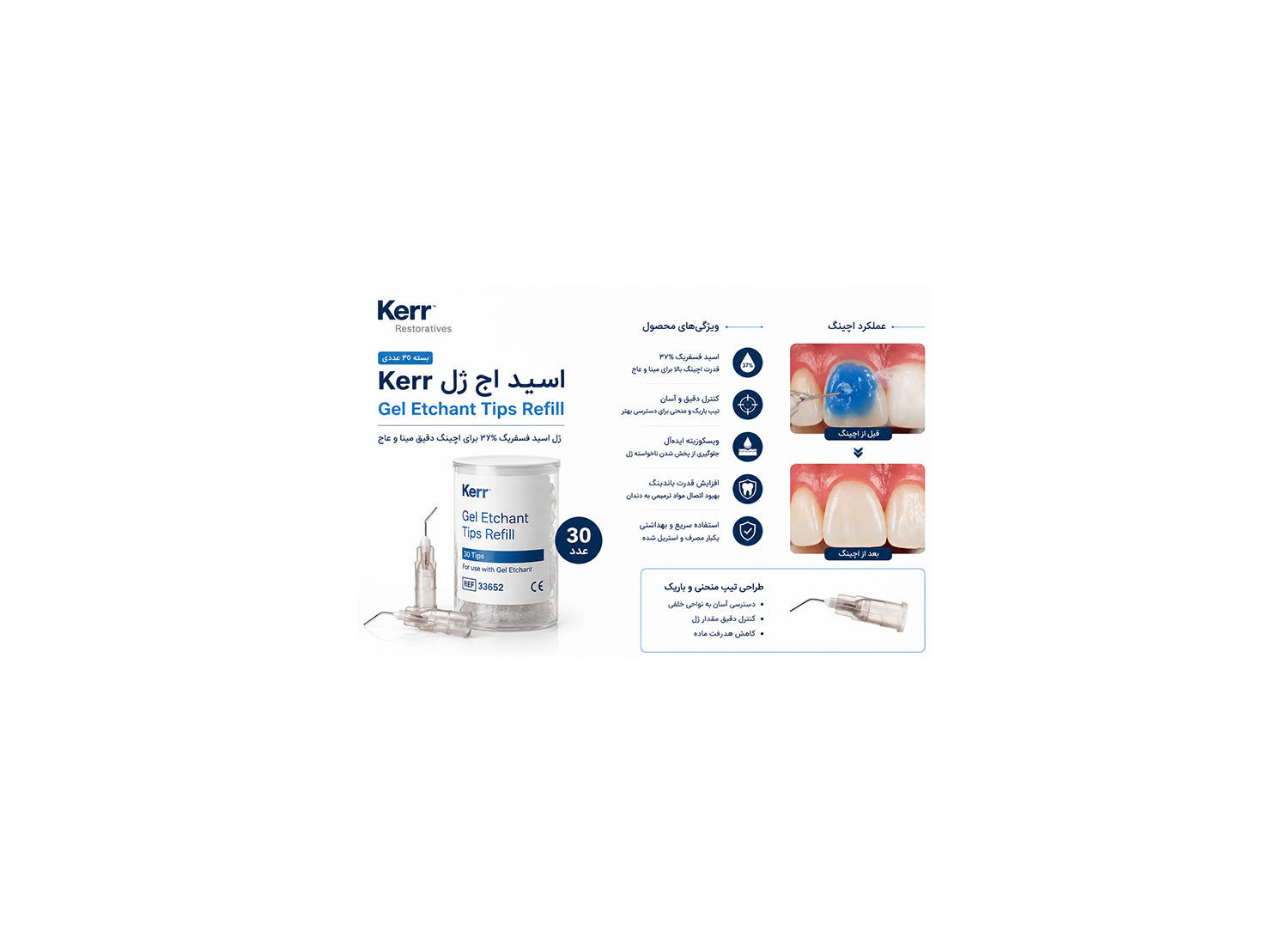 سری ژل اسید اچ بسته 30 عددی برند Kerr Dental