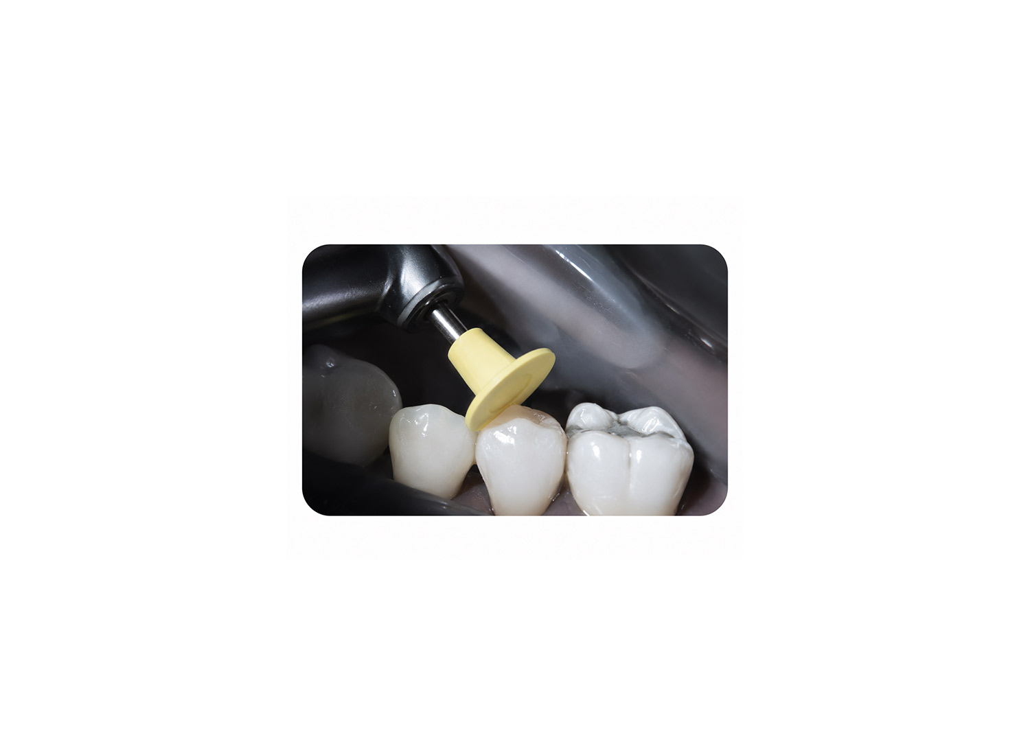 پالیشر کامپوزیت Identoflex برند Kerr Dental