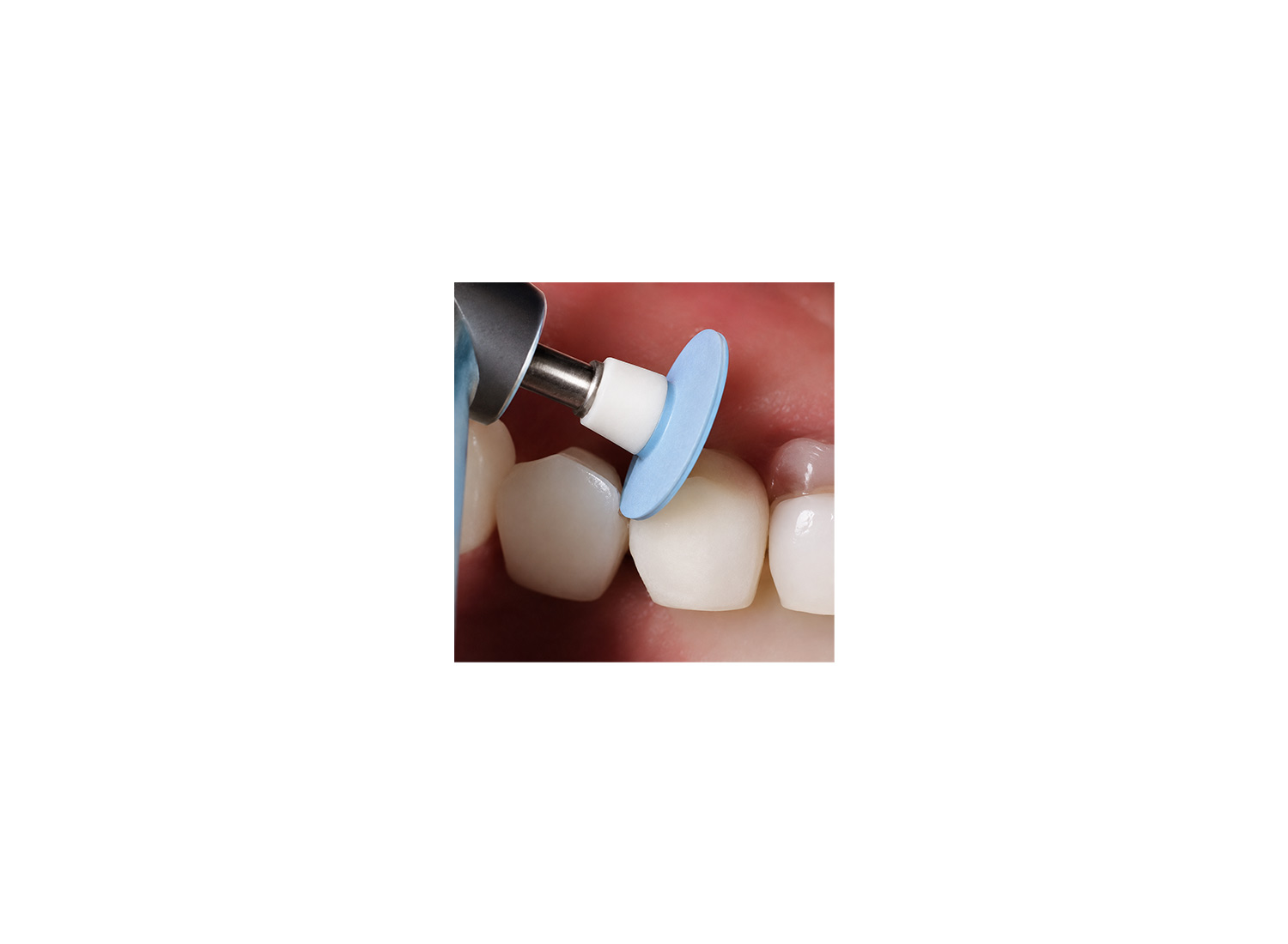 پالیشر کامپوزیت الماسه برند Kerr Dental