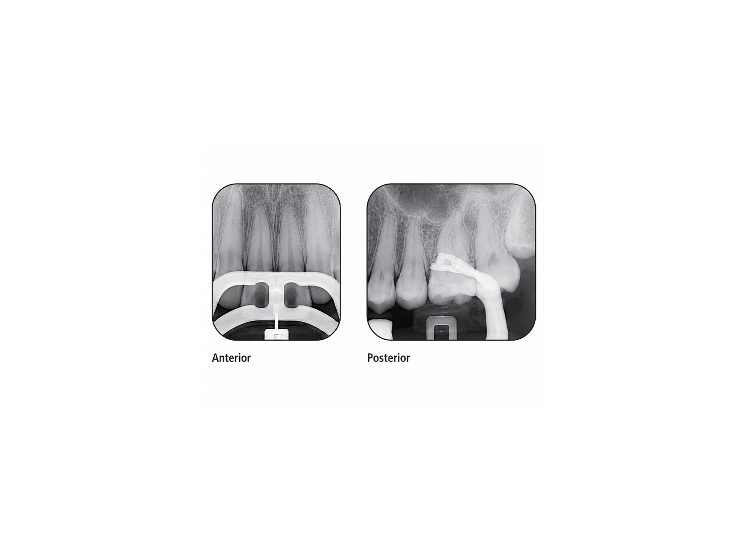 هولدر رادیوگرافی اندودنتیک Endo-Bite Kerr برند Kerr Dental