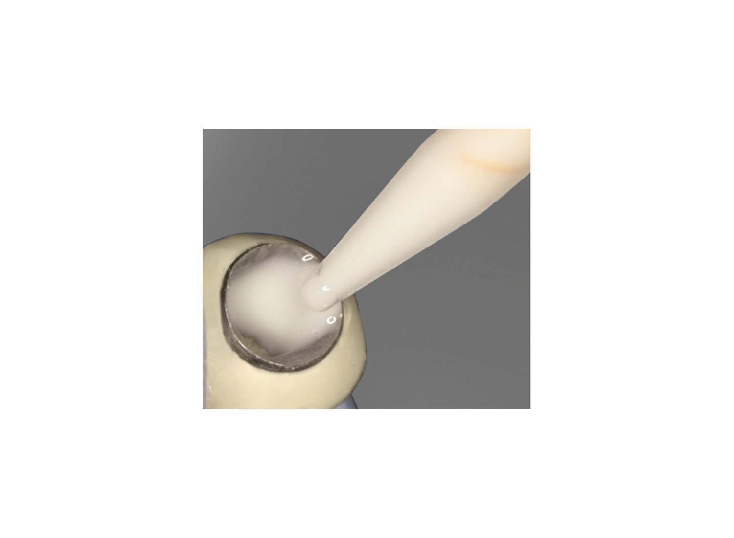 سمان رزینی نیمه موقت ایمپلنت implantlink برند DETAX